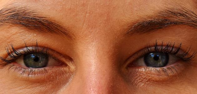 القضاء على تجاعيد العين نهائيا