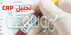 ماذا يدل ارتفاع تحليل crp