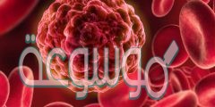 تنتج في مرض اللوكيميا سرطان الدم بأعداد هائلة