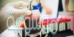 لكي لا تكون جلطة دموية يجب التأكد من فصائل دم كل من المريض والمتبرع قبل عملية نقل الدم