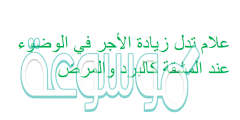 علام تدل زيادة الأجر في الوضوء عند المشقة كالبرد والمرض