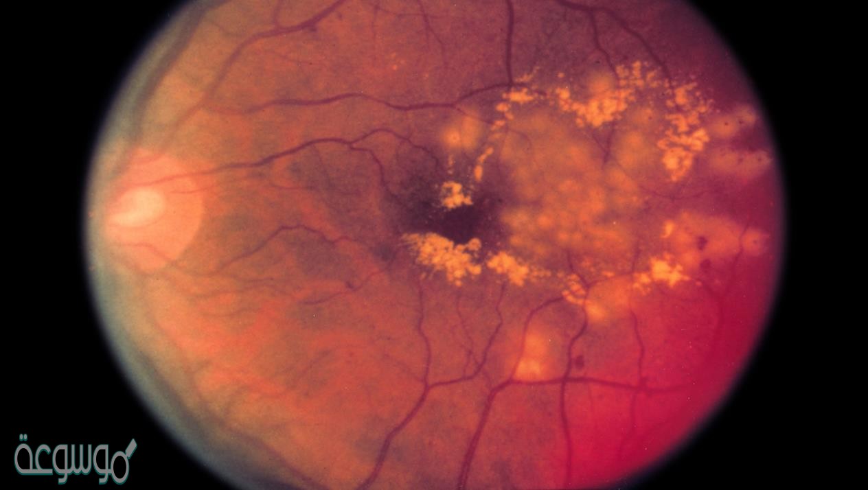 تتركب الشبكية من نوعين من الخلايا