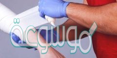 صف طريقة واحدة يستطيع الأطباء من خلالها علاج الإصابات الحادة في الجلد الناتجة عن الحروق او الجروح او العمليات