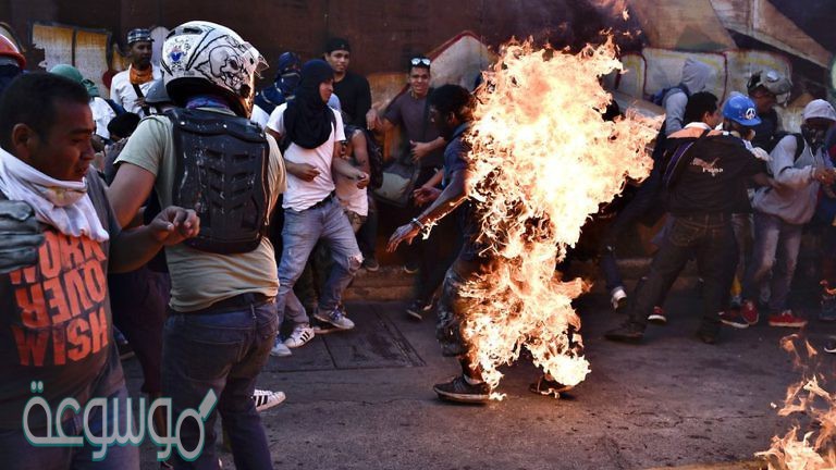 لماذا يكون الشخص المصاب بحروق متعددة وخطيرة عرضة للموت بسبب فقدان الماء