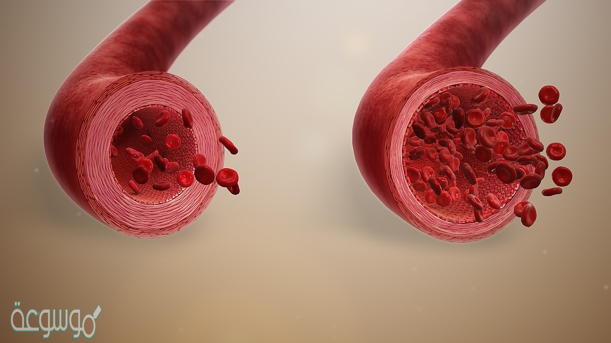 ما الذي قد يحدث لدرجة حرارة الجسم اذا لم تحتو الاوعية الدموية على العضلات الملساء
