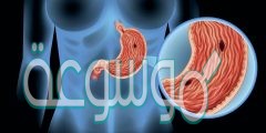 ما المصطلح المناسب الذي يصف المعدة؟
