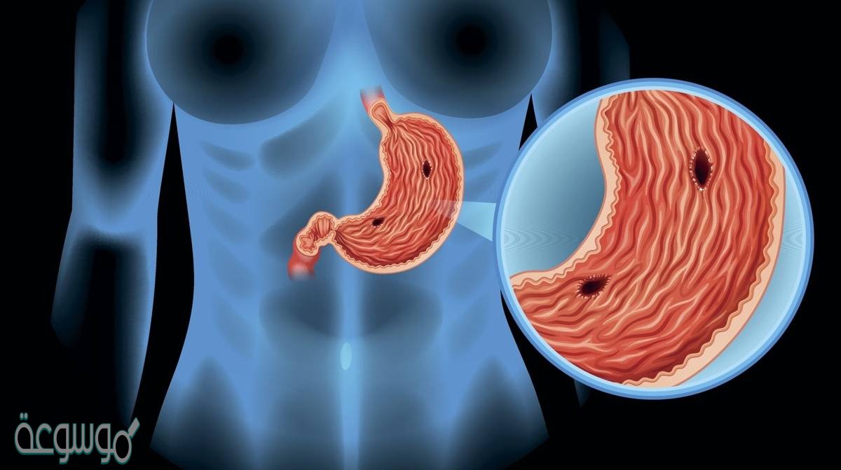 المصطلح المناسب الذي يصف المعدة