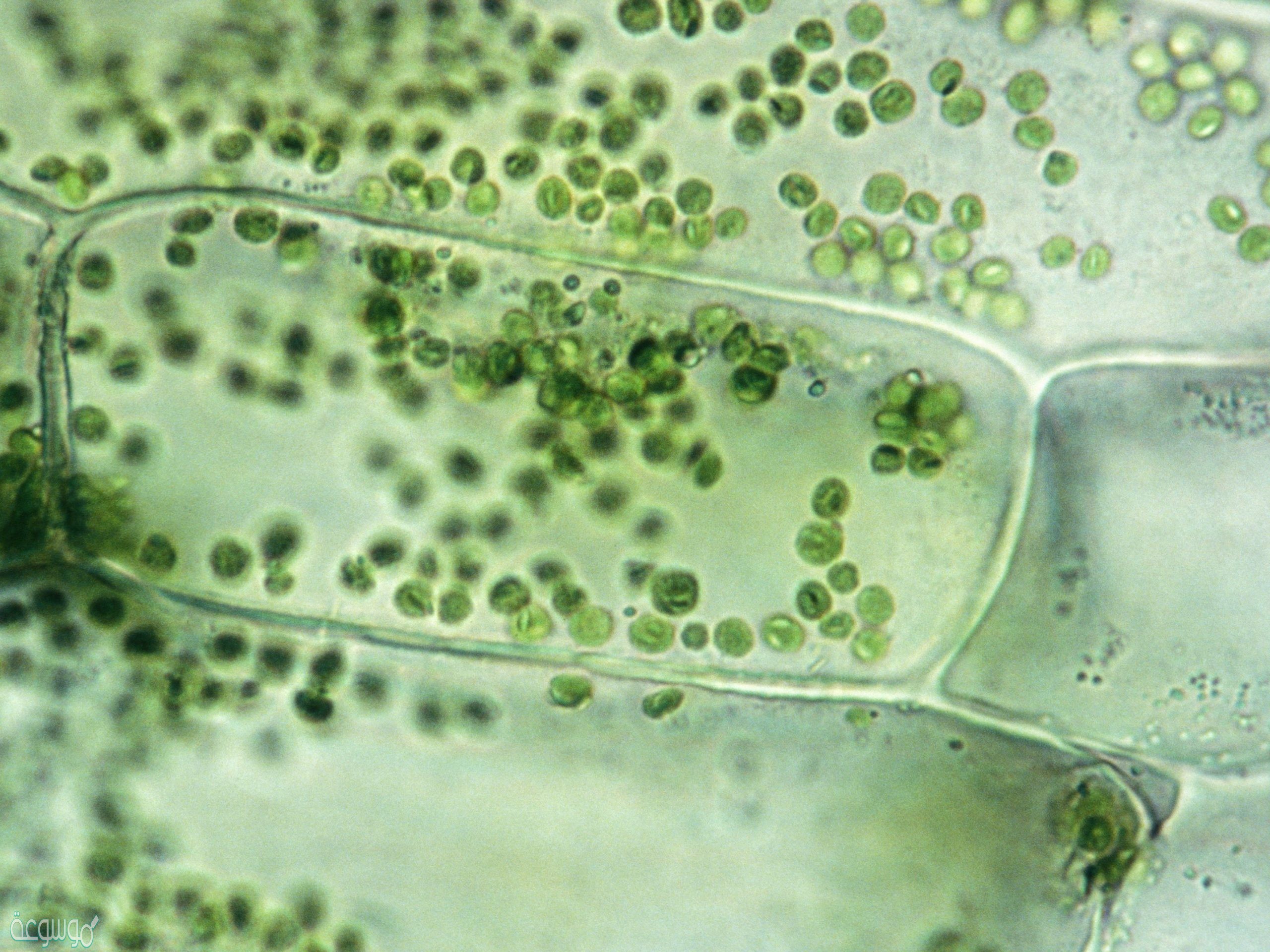 تحتوي خلايا ..................... على أعداد كبيرة من البلاستيدات الخضراء