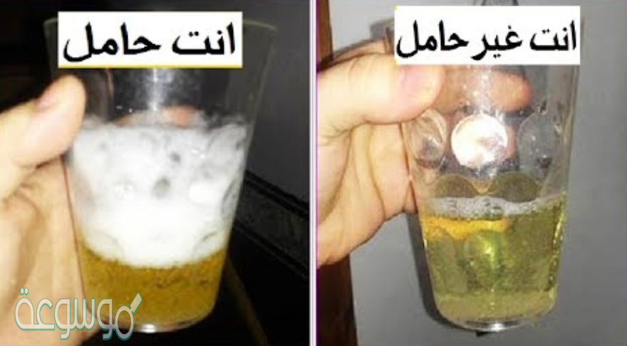 تحليل الحمل بالكلور بالصور