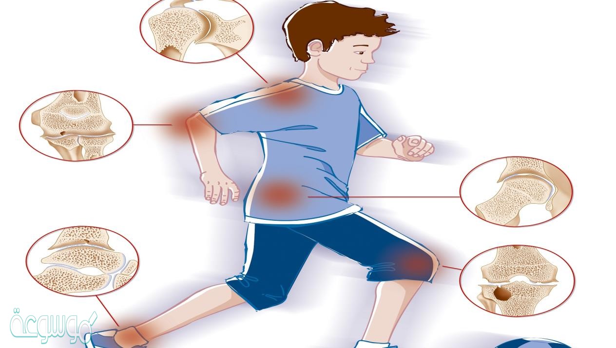 توجد المفاصل غير المتحركه فى الإنسان في؟