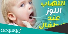 علاج اللوز عند الأطفال مجرب والحالات التي تستدعي زيارة الطبيب