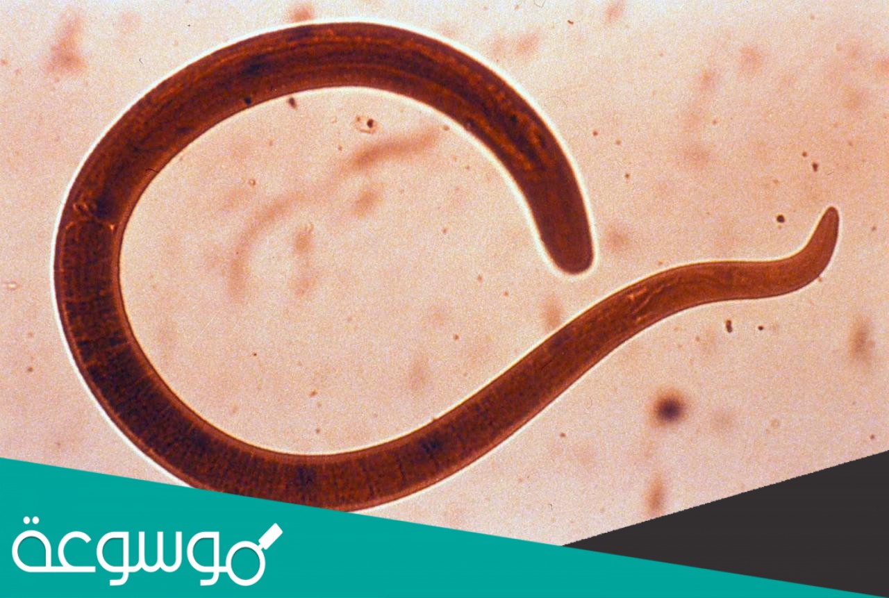 لماذا سميت الديدان بهذا الاسم