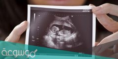 ما هي فائدة السائل الامنيوي المحيط بالجنين ؟