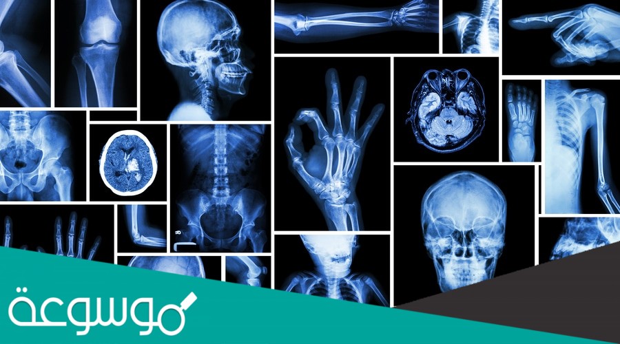 الأشعة السينية