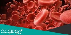 حالة نقص في حجم او عدد كريات الدم الحمراء