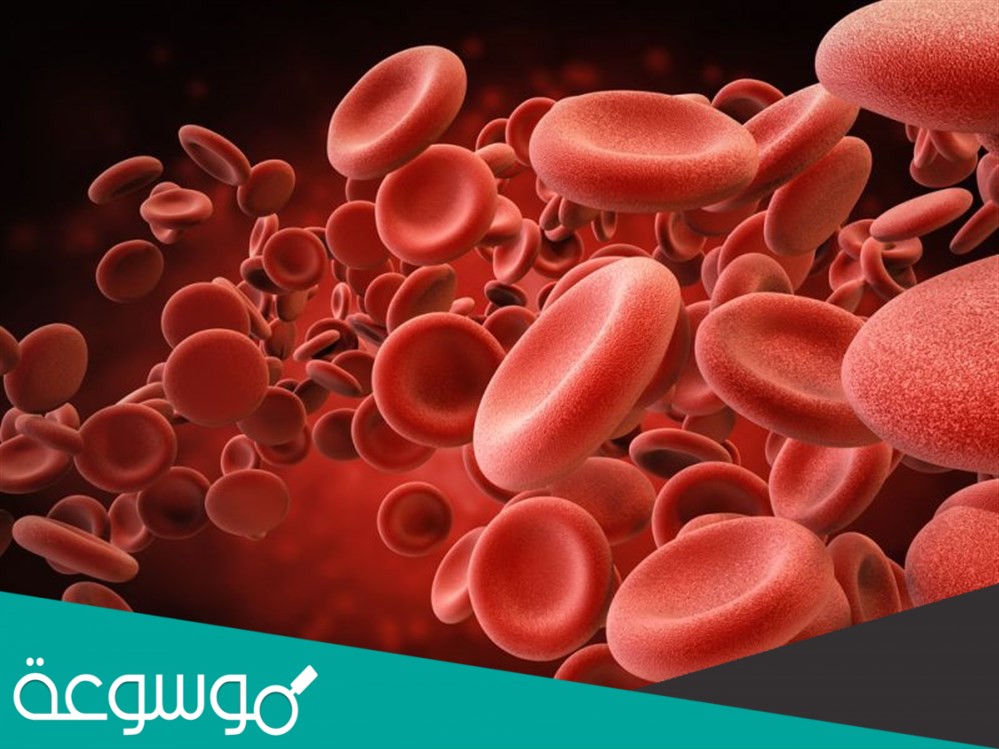 حالة نقص في حجم او عدد كريات الدم الحمراء