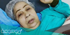 الحالة الصحية الفنانة فاطمة كشري