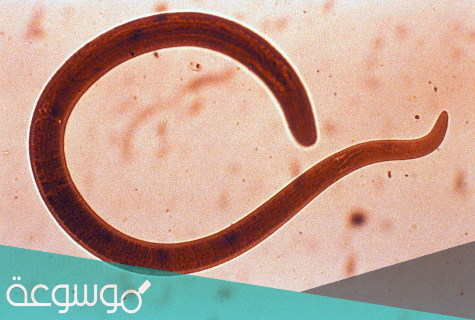 الدودة الشريطية