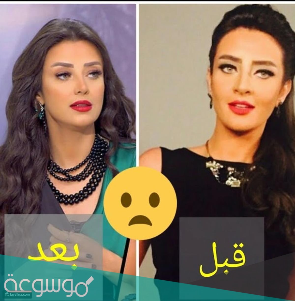 رضوى الشربينى قبل وبعد