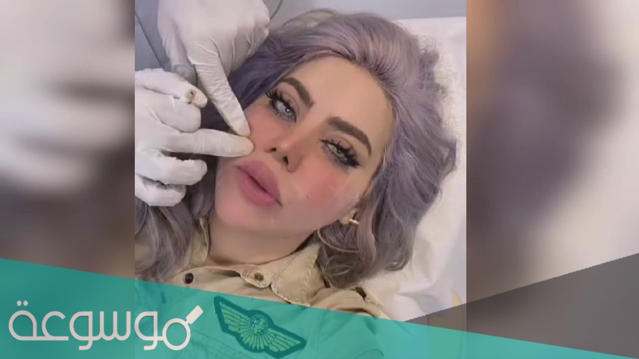 مروة راتب قبل وبعد التجميل