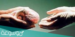 إجراءات التبرع بالأعضاء بعد الوفاة في السعودية