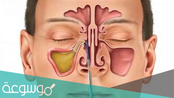 كم عدد الجيوب الأنفية الموجودة داخل جسم الإنسان؟