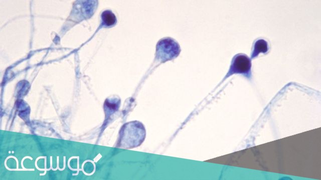 وباء الفطر الاسود