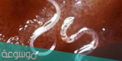 كيف تصيب دودة الاسكارس الانسان