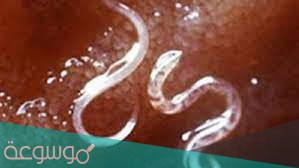 كيفكيف تصيب دودة الاسكارس الانسانتصيب دودة الاسكارس الانسان