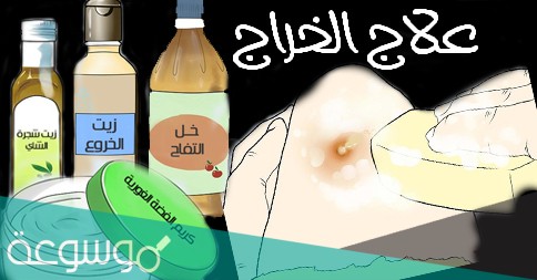 علاج فعال وسريع للدمامل