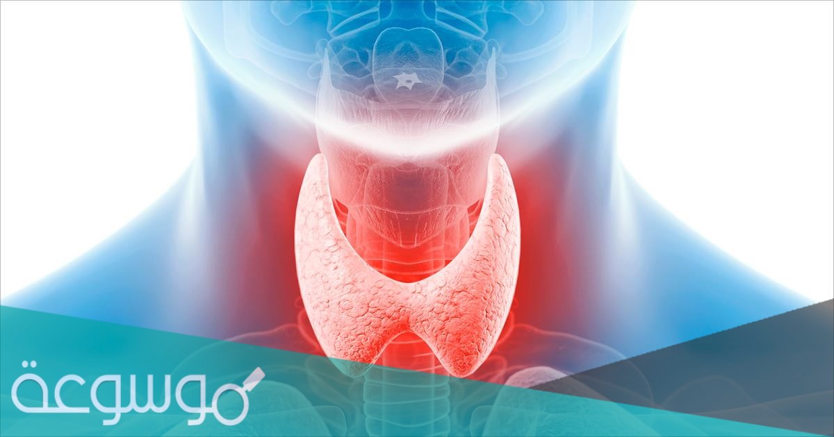 هل يمكن الشفاء من خمول الغدة الدرقية