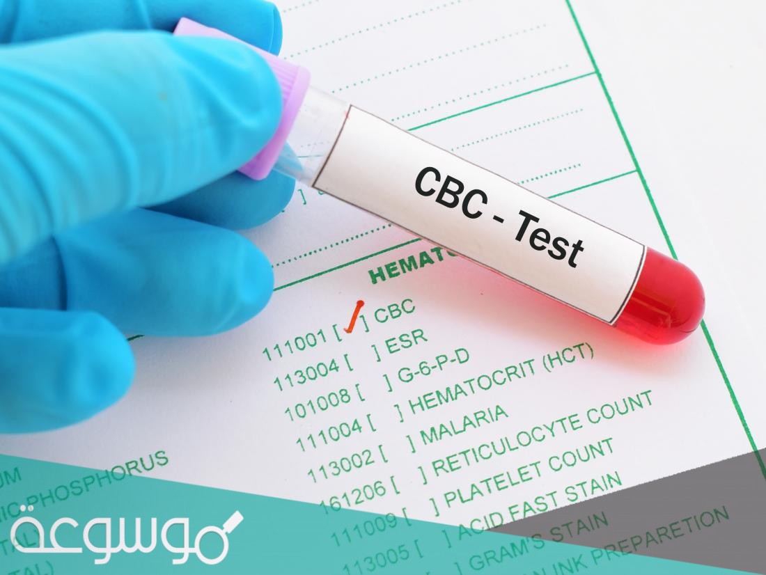 تحليل الدم الشامل ماذا يكشف؟ وخطوات ما قبل القيام بتحليل الدم الشامل