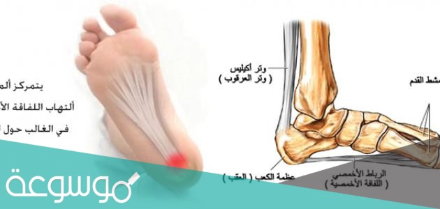 اخمص القدم ما هو