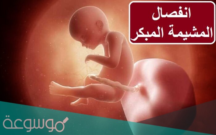 ما هي اسباب انفصال المشيمة