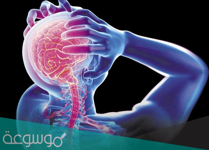 افضل دكتور مخ واعصاب في جدة