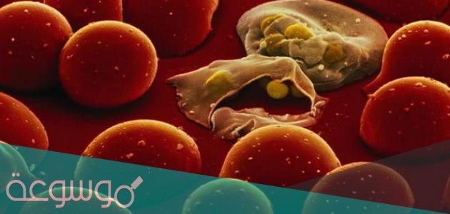 ما هو التلوث البكتيري