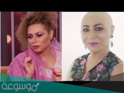 ما هو مرض زهرة الخرجي