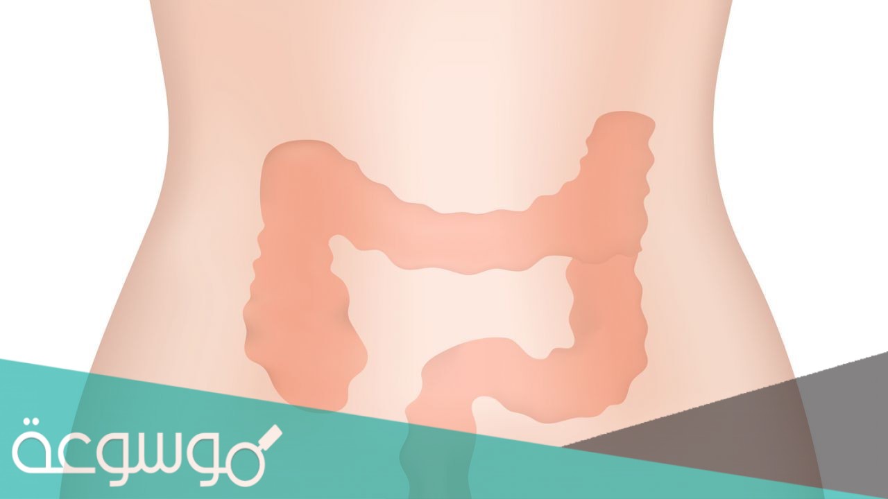 ما هو المصران الأعور ويكيبيديا