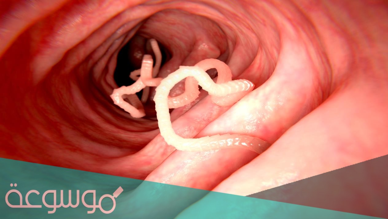 كيف يصاب الانسان بدودة الاسكارس