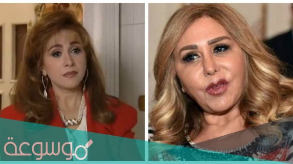 صور مها المصري بعد التجميل