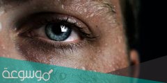 كيف يخرج العرق الى سطح الجلد
