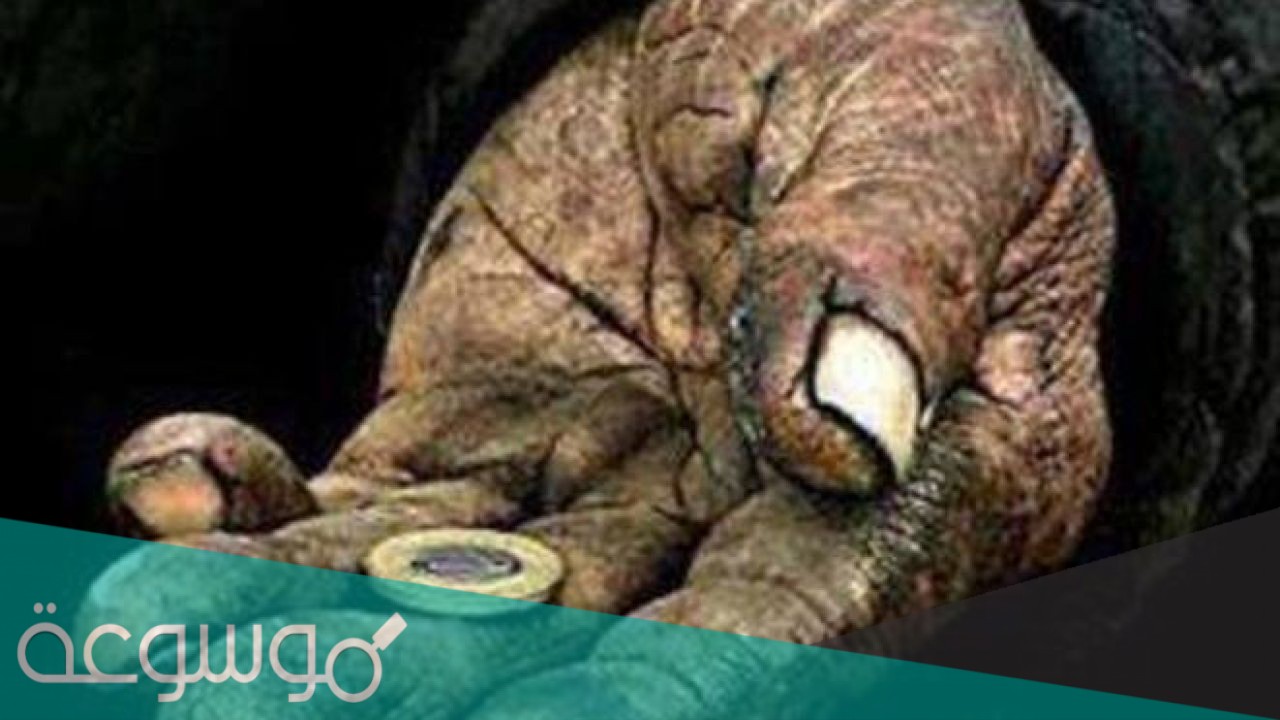 ما الفرق بين الفقير والمسكين