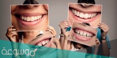 ما السبب المحتمل لتسوس الأسنان