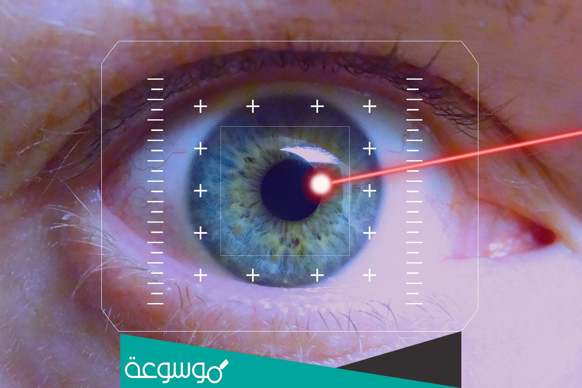 أسباب اختلاف قوة النظر بين العينين