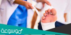 أسباب وعلاج القدم السكرية