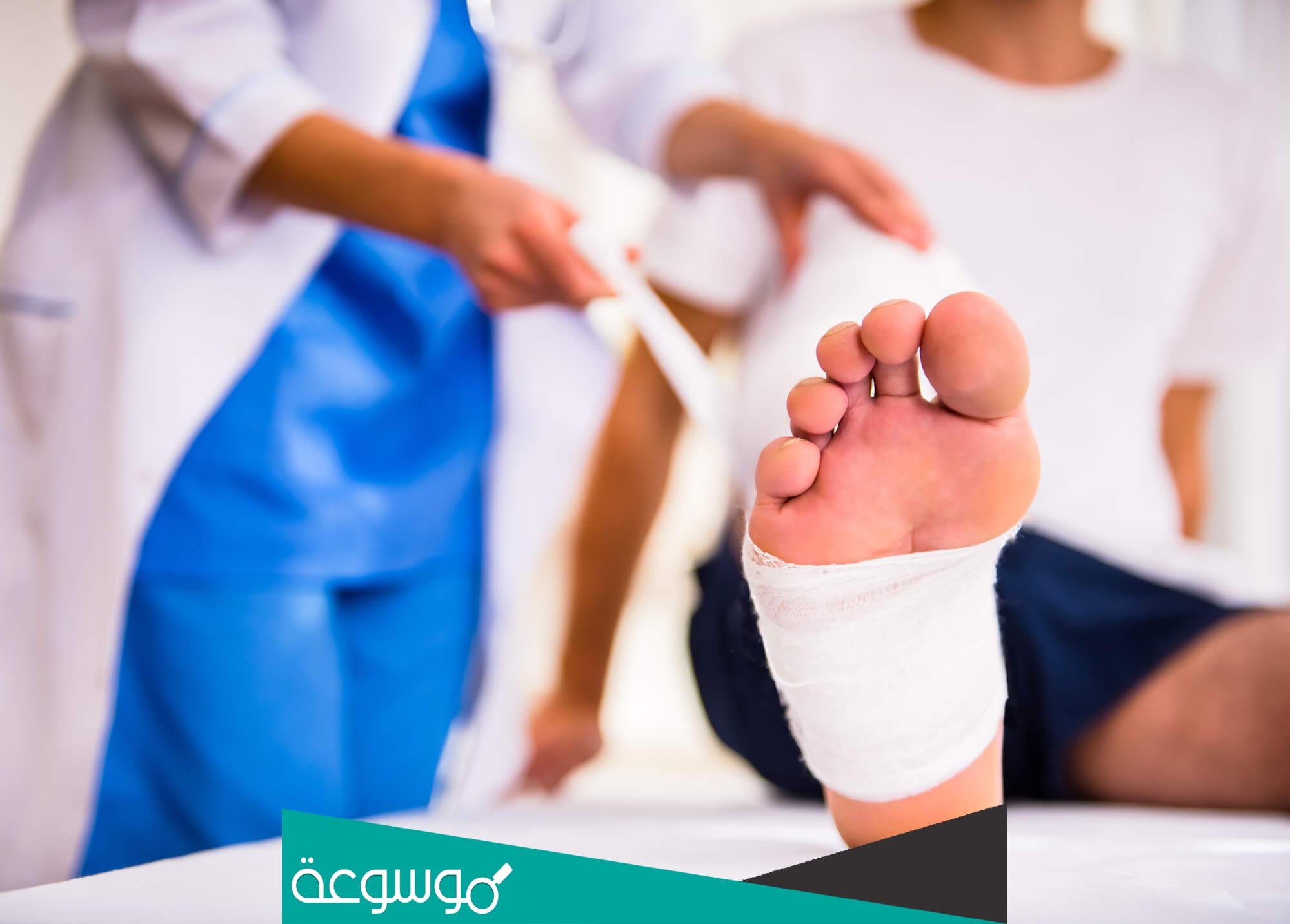 أسباب وعلاج القدم السكرية