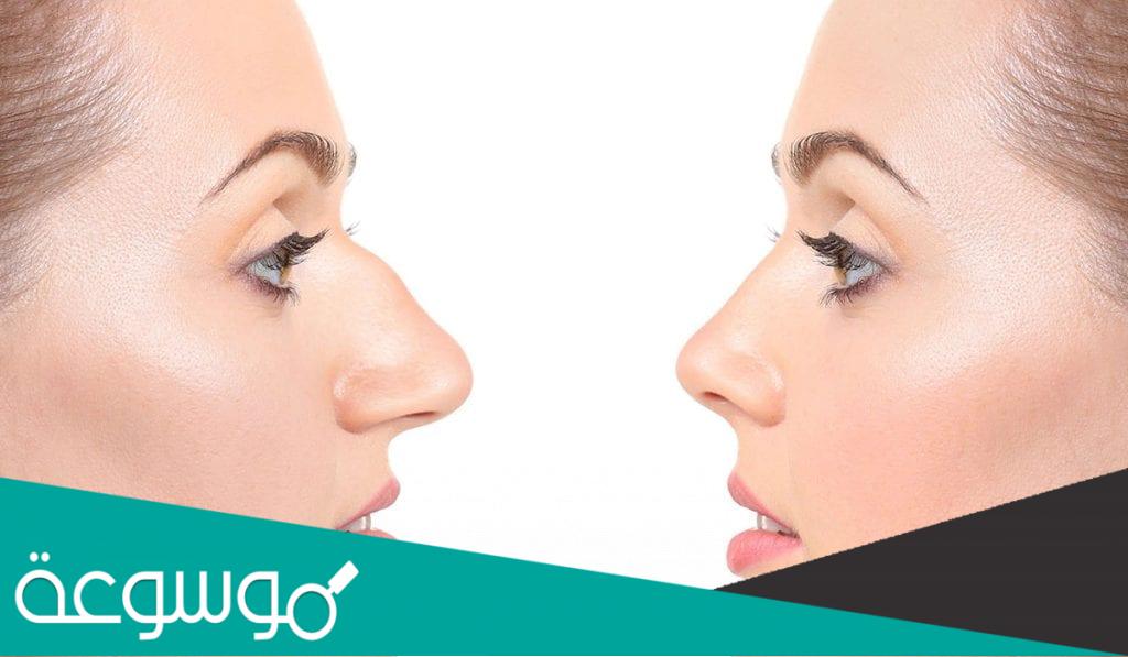 أنواع عمليات تجميل الأنف