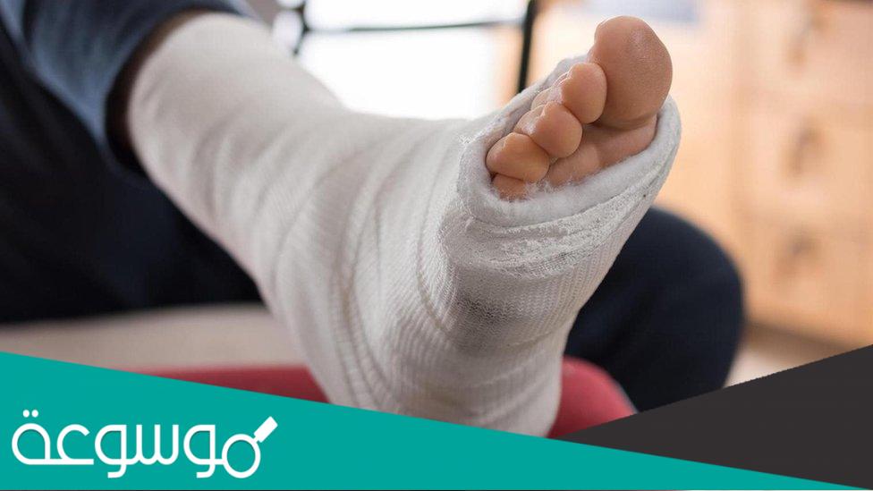 أنواع كسور إصبع القدم و أهم أعراضها