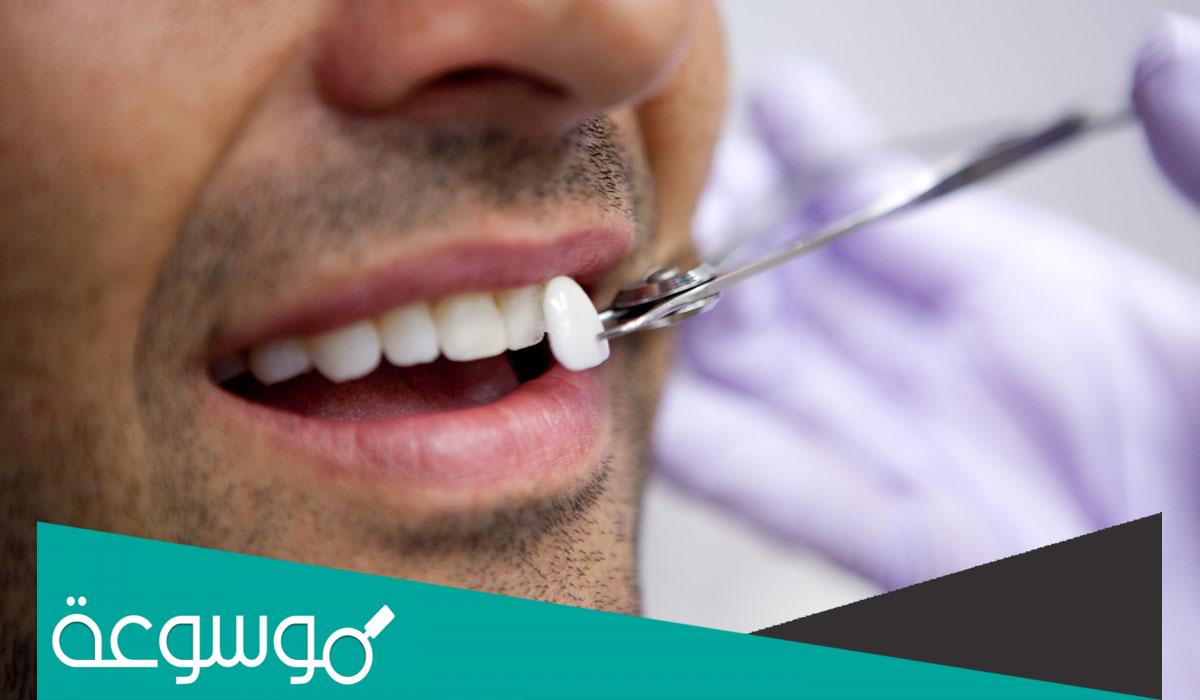 الإسعافات الأولية لإصابات الأسنان