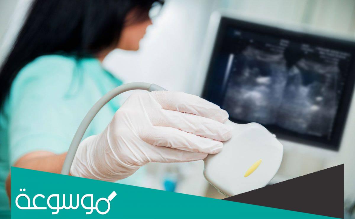 الاحتياطات بعد تركيب اللولب